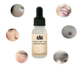 NATURAL SPOTS FREE SERUM