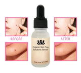 NATURAL SPOTS FREE SERUM