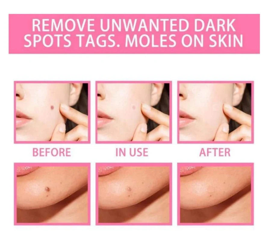 NATURAL SPOTS FREE SERUM