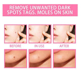 NATURAL SPOTS FREE SERUM