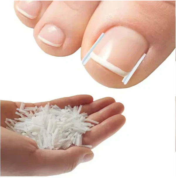 #1 Fungal Nail Patches