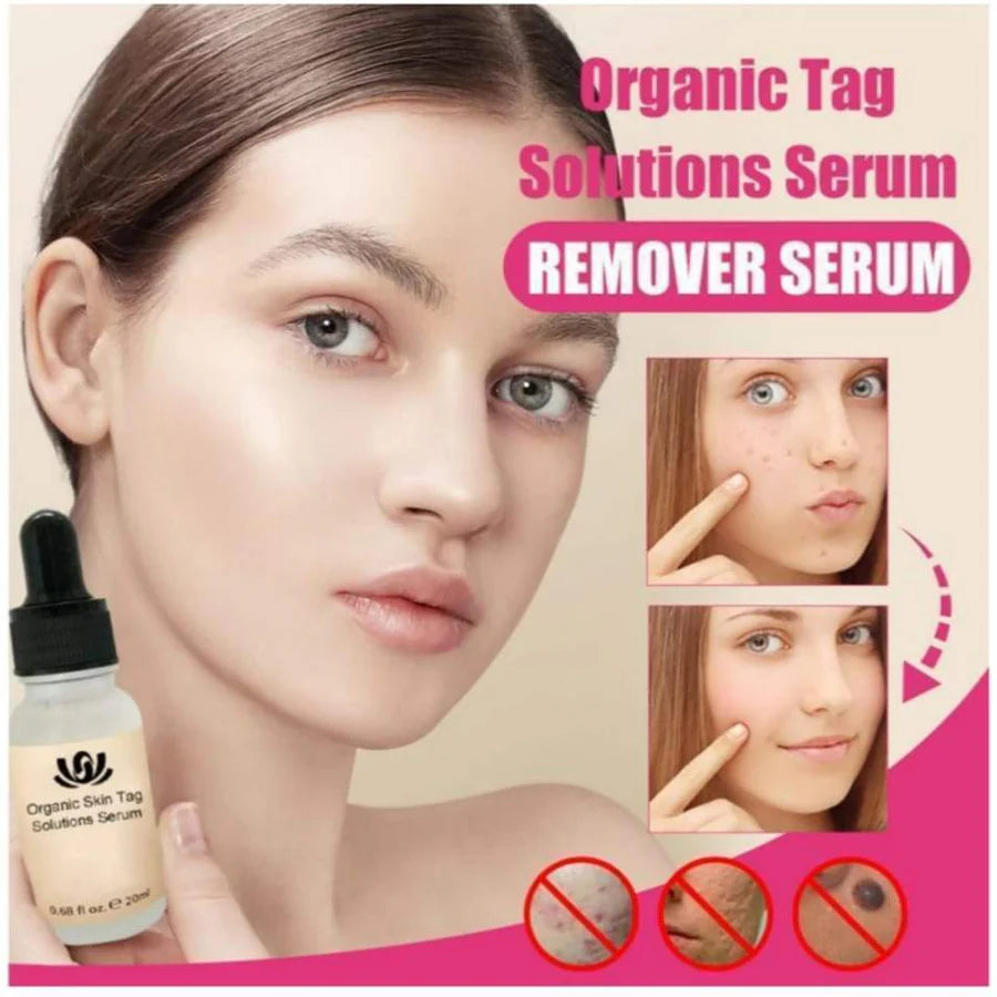 NATURAL SPOTS FREE SERUM