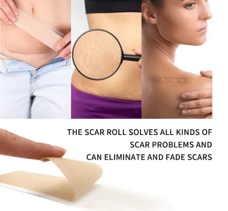 SILICONE SCAR TAPE