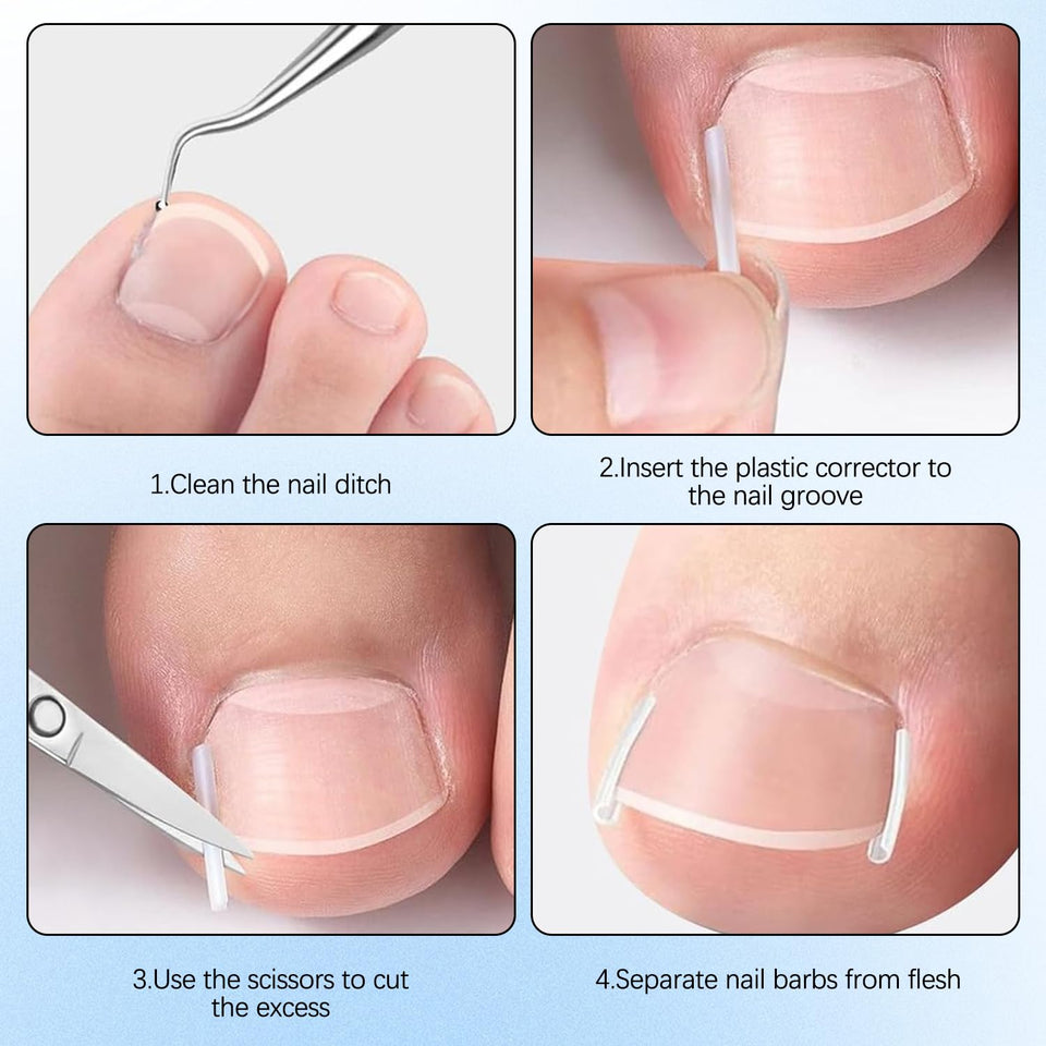 #1 Fungal Nail Patches
