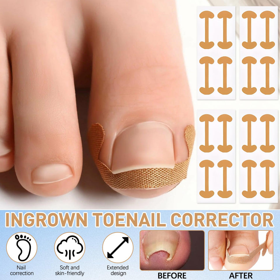 Toenail Correction Strips