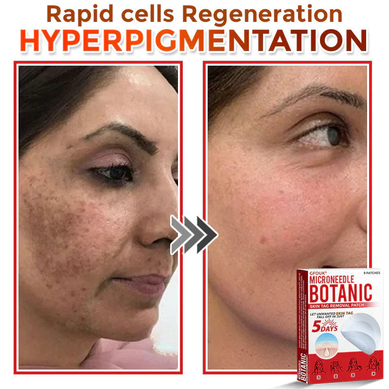 Micro Needle Botanic Patch