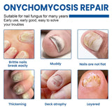 #1 Fungal Nail Patches