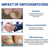 #1 Fungal Nail Patches