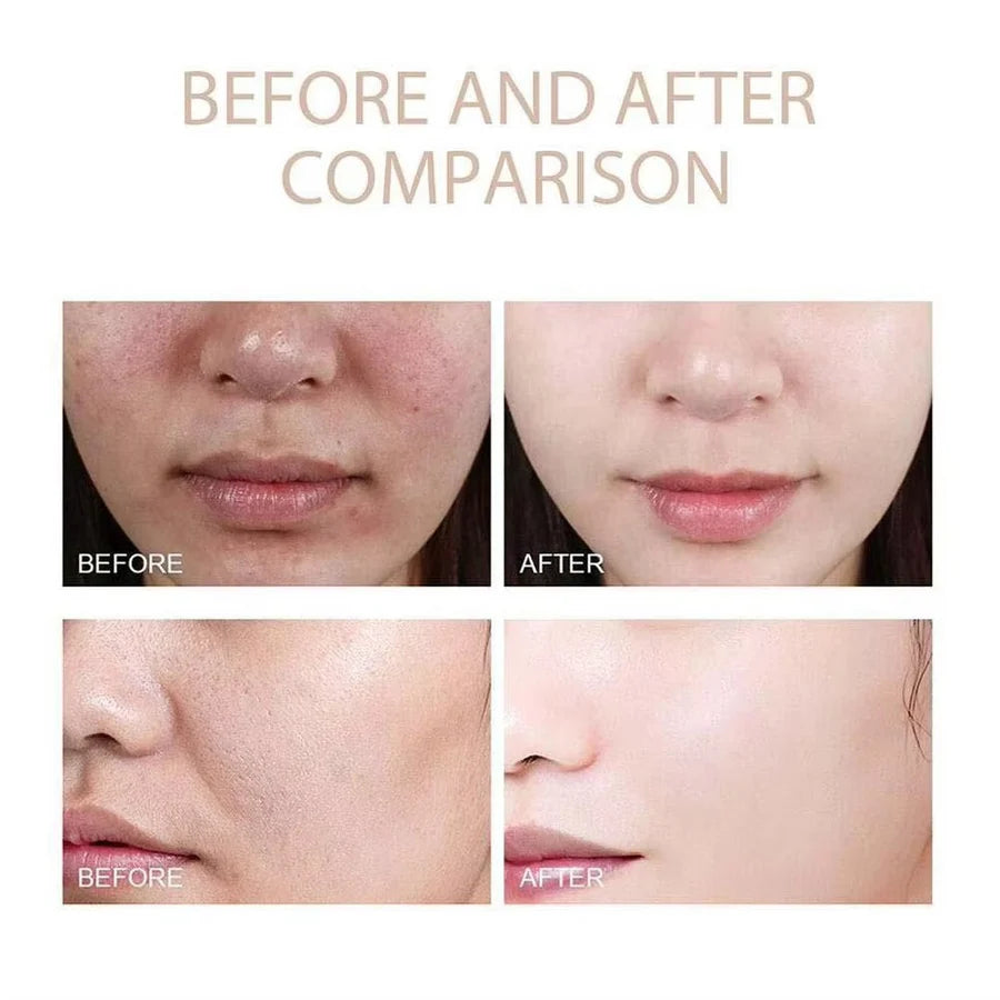 GlowRice™ Peel Shot