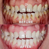 Ourlyard™ Tooth Powder