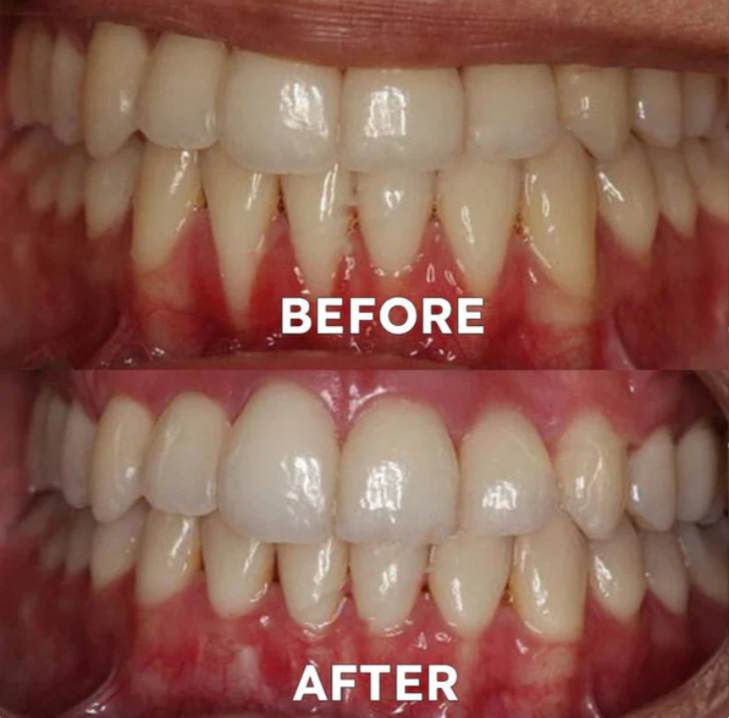 Ourlyard™ Tooth Powder