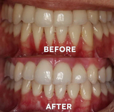 Ourlyard™ Tooth Powder