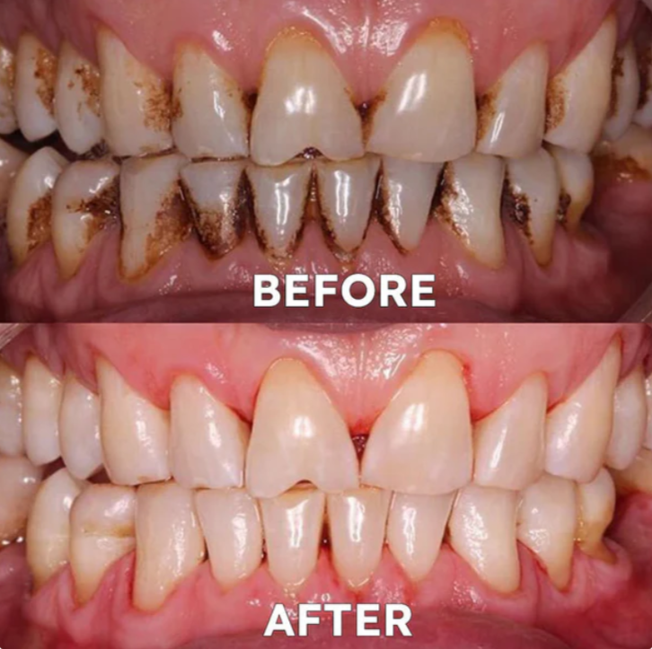 Ourlyard™ Tooth Powder