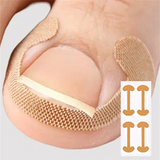 Toenail Correction Strips