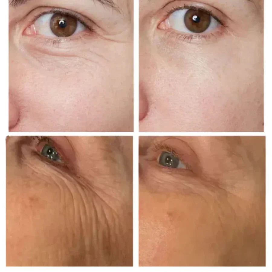 Instant Eye Tightener