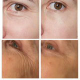 Instant Eye Tightener