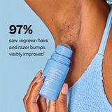 Ingrown Hair Treatment