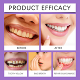 Teeth Whitening Strips