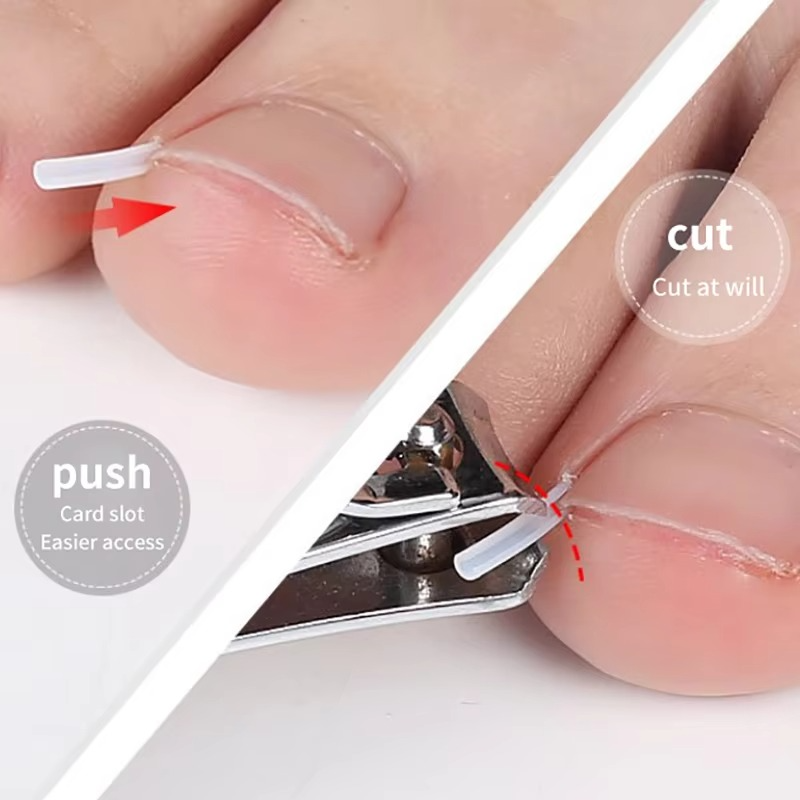 Toenail Correction Strips
