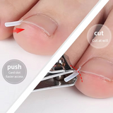 Toenail Correction Strips