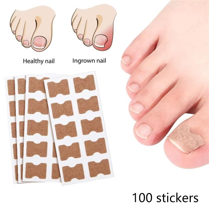 Toenail Correction Strips