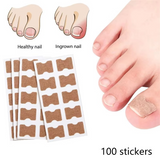 Toenail Correction Strips