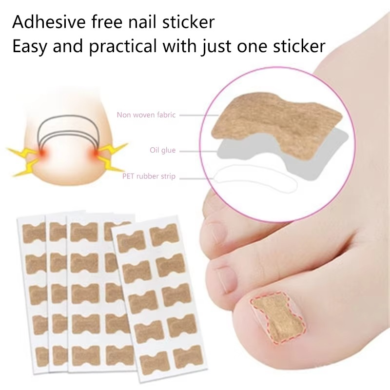 Toenail Correction Strips