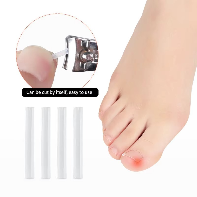 Toenail Correction Strips