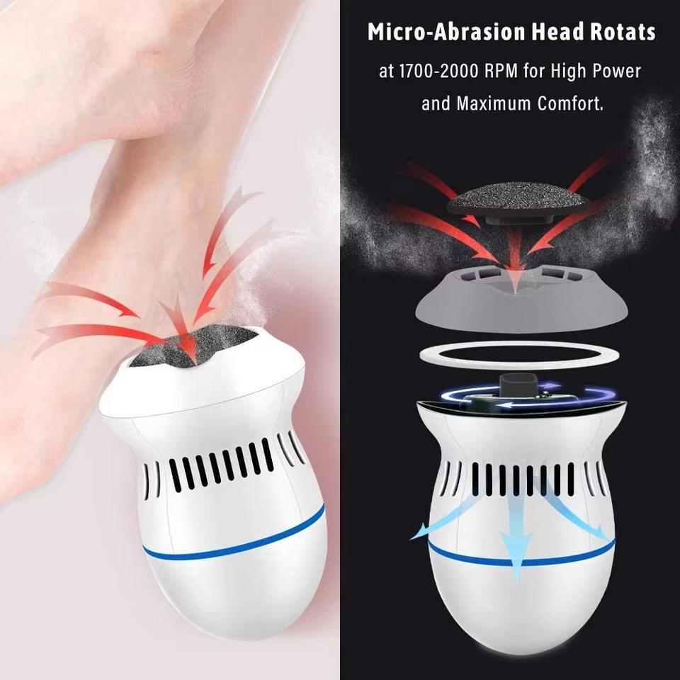 Electric Foot Callus Remover for Dead Skin Portable