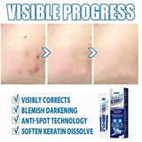 WartAway Herbal Cream