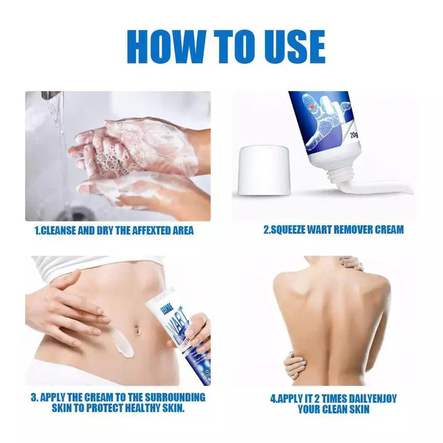 WartAway Herbal Cream